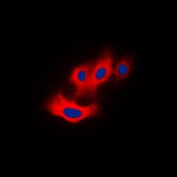 PAK4 Antibody (phospho-Ser474)