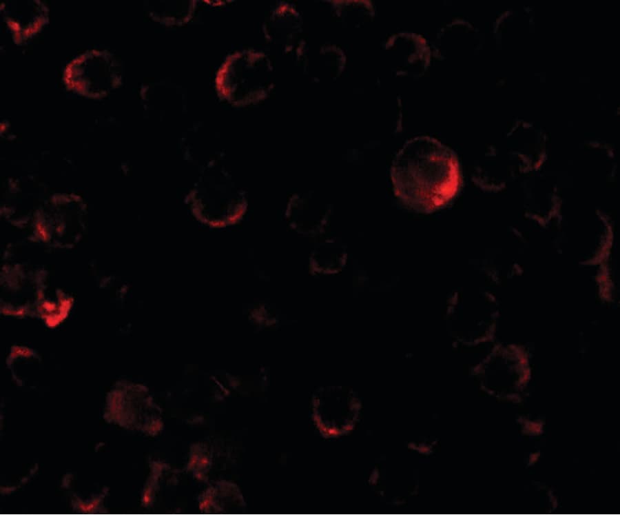 IHC-plus™ PHLPP2 / PHLPPL Antibody