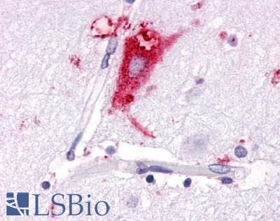 PathPlus™ GPR63 Antibody (C-Terminus)