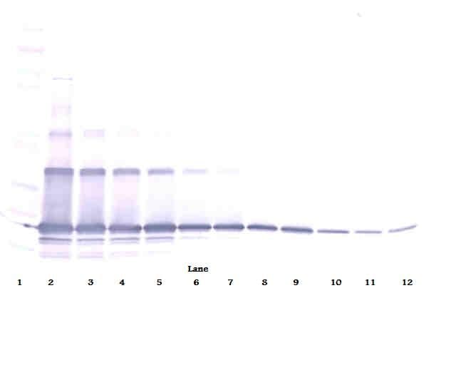 IHC-plus™ TNFSF11 / RANKL / TRANCE Antibody