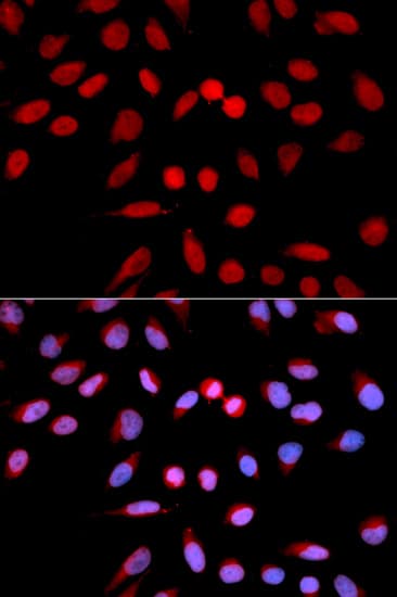 IHC-plus™ PPP1CA / PP1-Alpha Antibody