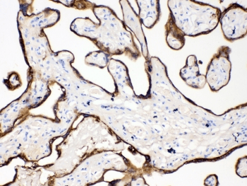 Polyclonal Rabbit anti-Human KRT18 / CK18 / Cytokeratin 18 Antibody (IHC, WB)