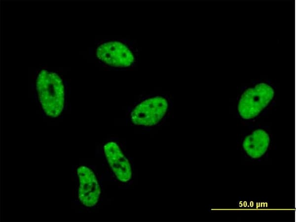 PathPlus™ Monoclonal Mouse anti-Human SF1 Antibody (clone 2E12, IHC, IF, WB)