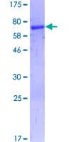 Human PDCD2 Protein (Recombinant GST)