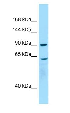 Polyclonal Rabbit anti-Human WHAMM Antibody (aa599-648, WB)