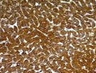 Hepatocyte Specific Antigen Antibody (clone SPM582, Azide-free, BSA-free)
