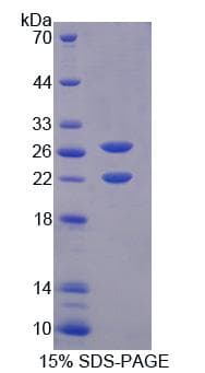 Mouse AVPI1 Protein (Recombinant His, N-Terminal)