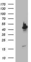 TUBB2A / Tubulin Beta 2A Antibody (clone OTI3E6)