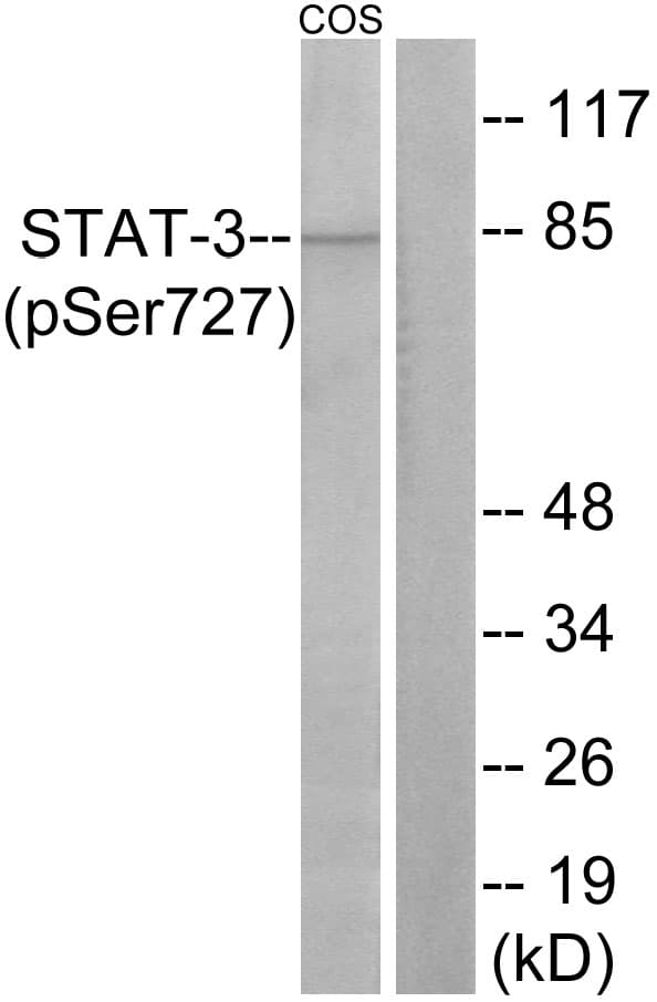 STAT3 Antibody (phospho-Ser727)