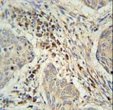Polyclonal Rabbit anti-Human KXD1 / C19orf50 Antibody (aa59-85, IHC, WB)