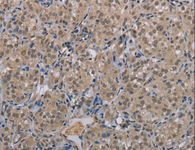 MGLL / Monoacylglycerol Lipase Antibody