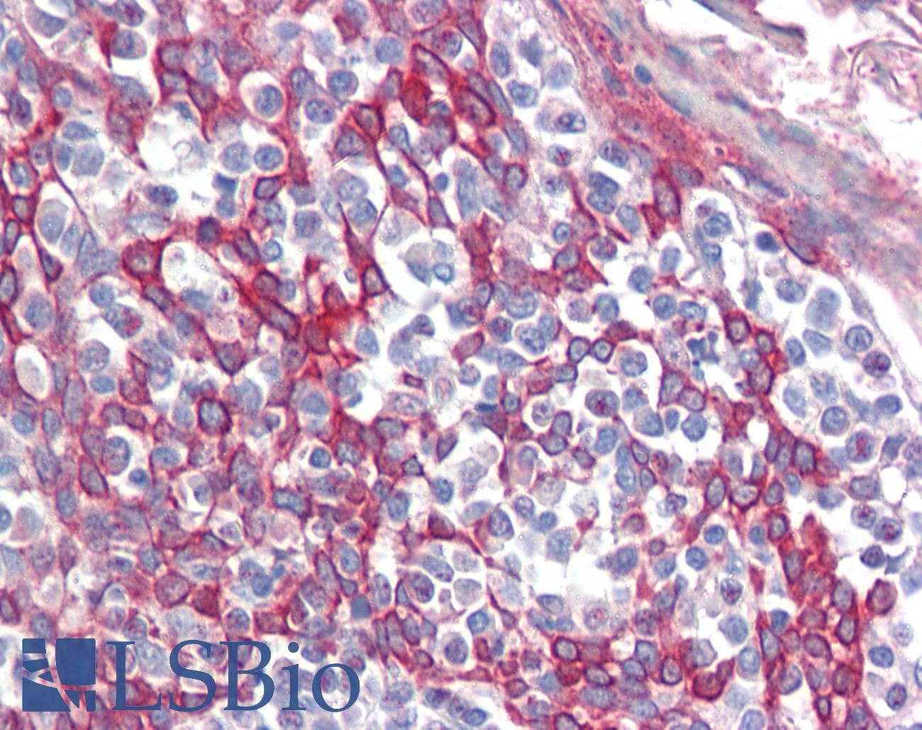 Polyclonal Rabbit anti-Human TRIM8 / GERP Antibody (aa36-85, IHC, WB)