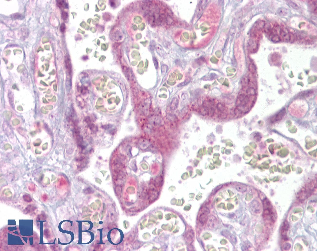 Polyclonal Rabbit anti-Mouse ATF4 Antibody (Biotin, N-Terminus, IHC, WB)