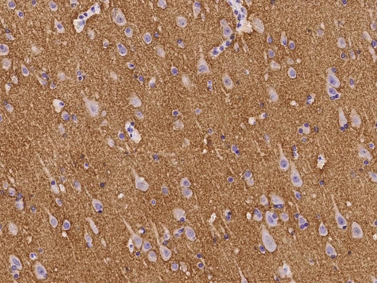 Polyclonal Rabbit anti-Human NCAN / Neurocan Antibody (IHC)