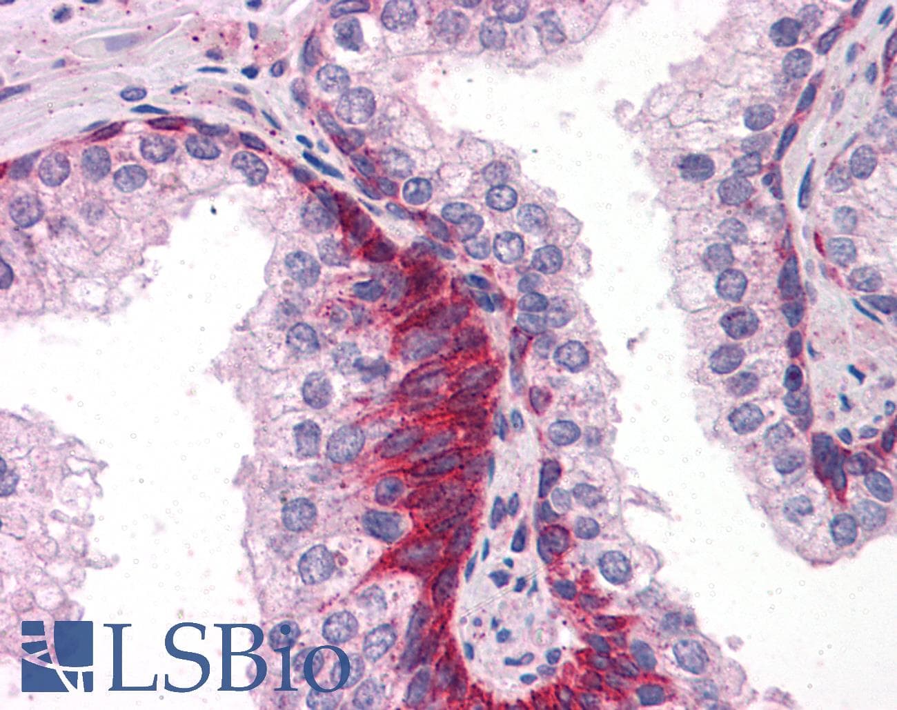 IHC-plus™ TRAF6 Antibody