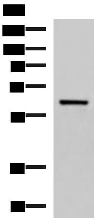Polyclonal Rabbit anti-Human SARS / Serine-tRNA Ligase Antibody (IHC, WB)