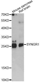 Polyclonal Rabbit anti-Human SYNGR1 / Synaptogyrin 1 Antibody (WB)