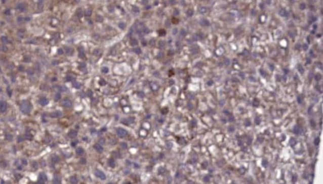 KIR2DL1 / CD158a Antibody