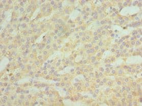 Polyclonal Rabbit anti-Human ASAH1 / Acid Ceramidase Antibody (aa146-395, IHC, WB)