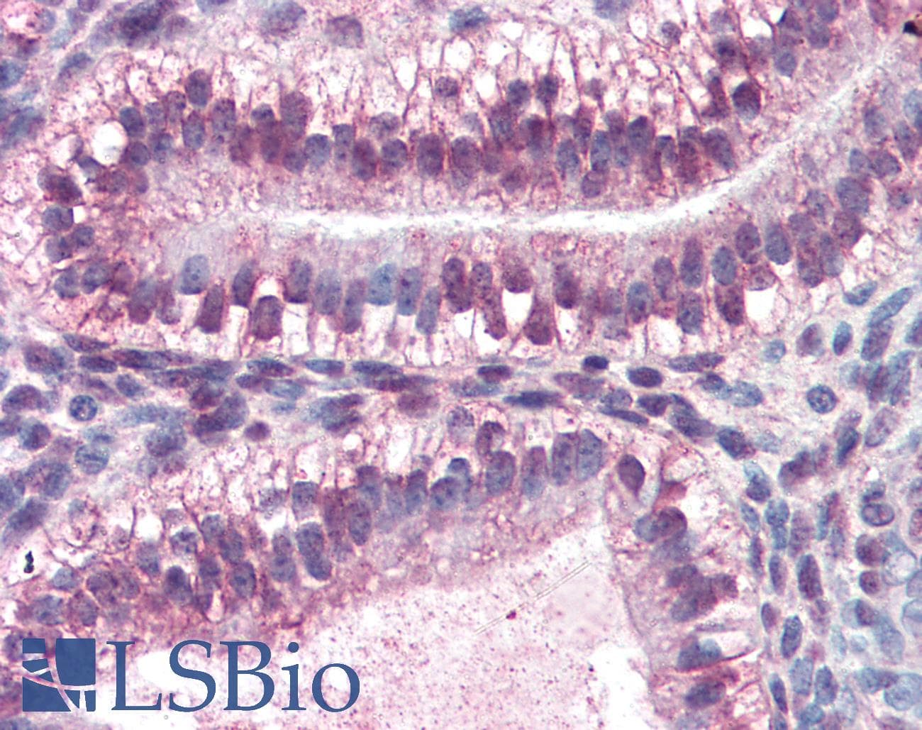 IHC-plus™ Monoclonal Mouse anti-Human CRABP2 Antibody (clone AT2E11, aa1-138, IHC, WB)