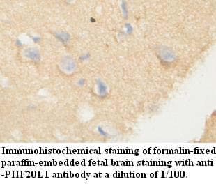 PHF20L1 Antibody (aa734-1012)