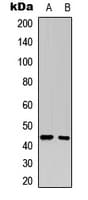 MAP2K1 / MKK1 / MEK1 Antibody (Internal)