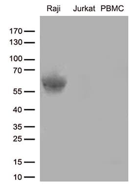 Monoclonal Mouse anti-Human CD80 Antibody (clone OTI1A10, WB)