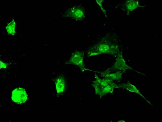 Polyclonal Rabbit anti-Human STUB1 / CHIP Antibody (IHC, IF, WB)