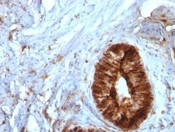 B2M / Beta 2 Microglobulin Antibody (clone B2M/961, Ready-to-Use)