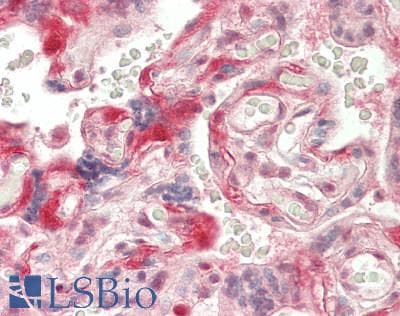 IHC-plus™ PSMC2 / RPT1 Antibody (aa150-200)