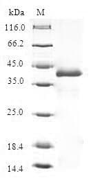 Human THRSP Protein (Recombinant GST, N-terminus)