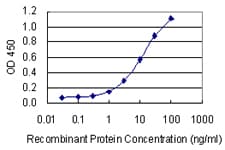 Monoclonal Mouse anti-Human TWIK1 / KCNK1 Antibody (clone 4D7, WB)