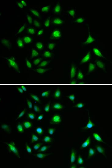Polyclonal Rabbit anti-Human CHUK / IKKA / IKK Alpha Antibody (IHC, IF, WB)