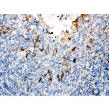 FLG / Filaggrin Antibody (aa1-261)