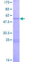 Human EGLN3 / PHD3 Protein (Recombinant GST)