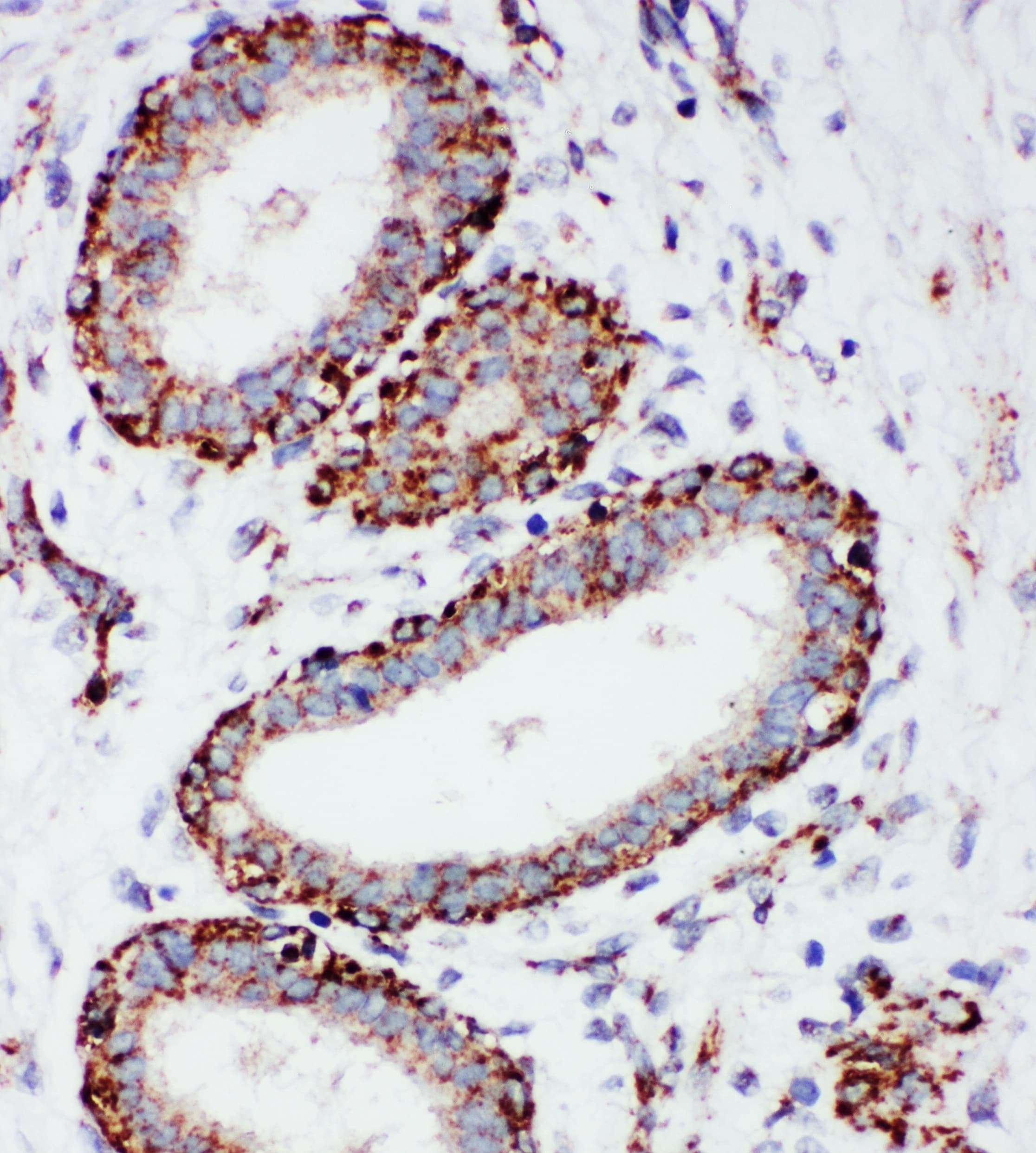 Polyclonal Rabbit anti-Human MT-CO1 / COX1 Antibody (aa501-514, IHC, WB)