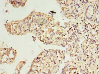 RWDD2A Antibody