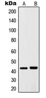 Polyclonal Rabbit anti-Human JUN / c-Jun Antibody (Internal, IHC, WB)
