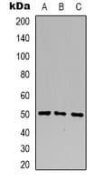 Polyclonal Rabbit anti-Human B4GALT1 Antibody (C-Terminus, IHC, WB)