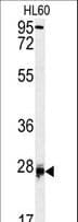 Polyclonal Rabbit anti-Human Dermatopontin / DPT Antibody (aa102-128, IHC, IF, WB)