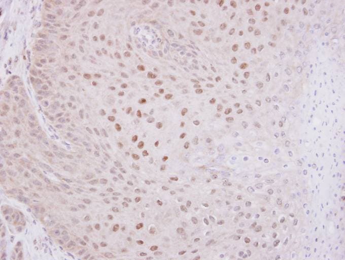 OGT / O-GLCNAC Antibody (aa223-502)