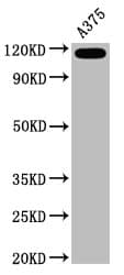 MCAM / CD146 Antibody