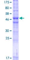 Human HARV1 / ARV1 Protein (Recombinant GST)