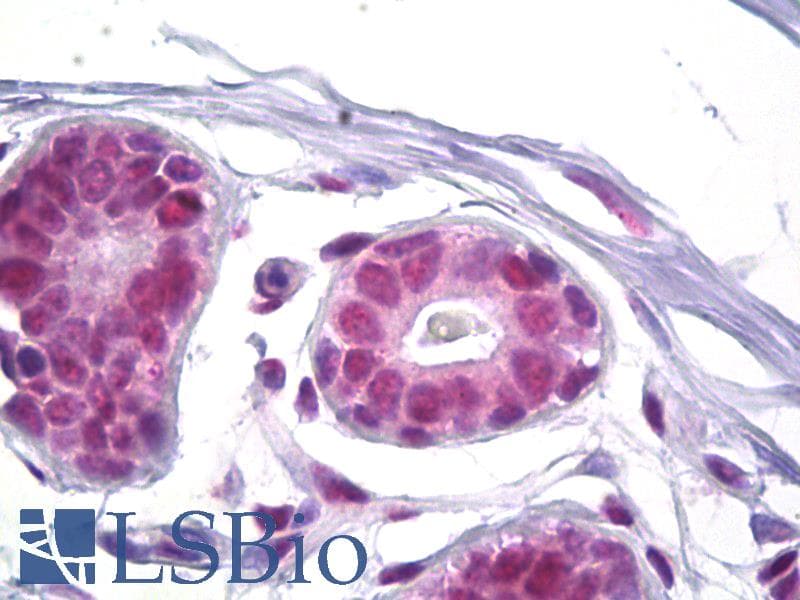 IHC-plus™ SSB / La Antibody (aa341-390)