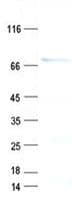 Human PPP2R3B Protein (Recombinant His, N-Terminal)