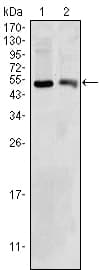 IHC-plus™ SDR9C1 / BDH1 Antibody (clone 1A5)