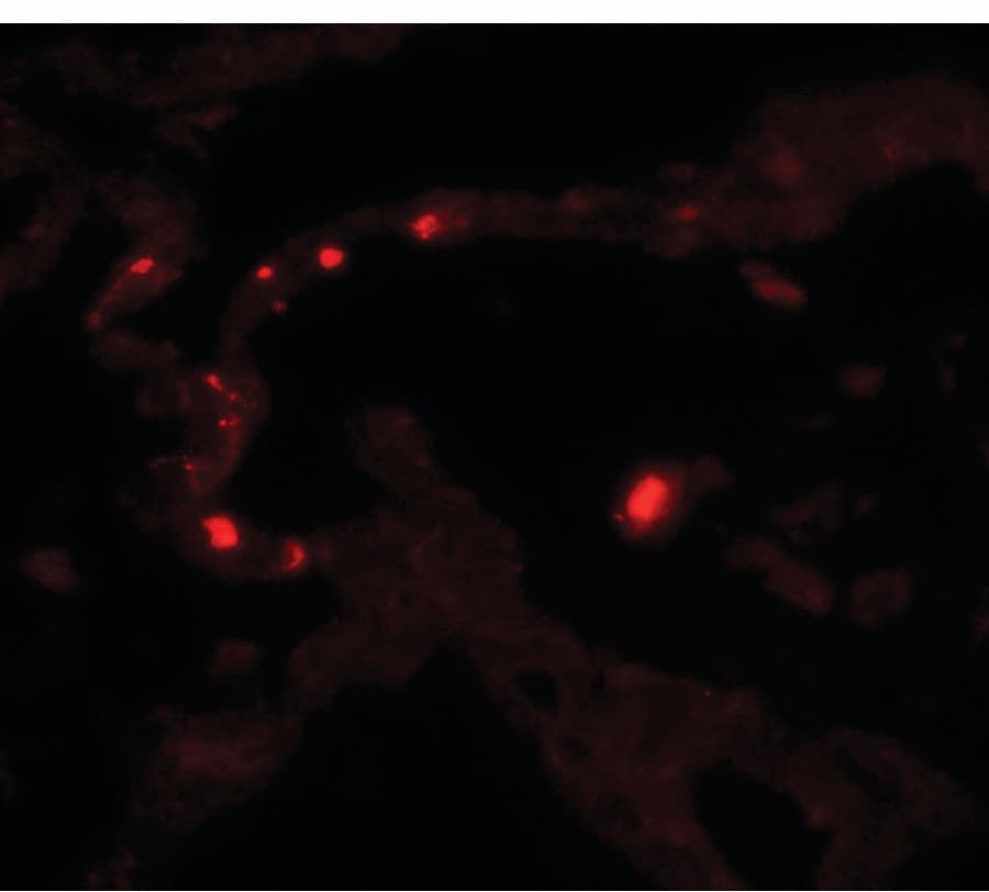 IHC-plus™ MMP9 / Gelatinase B Antibody
