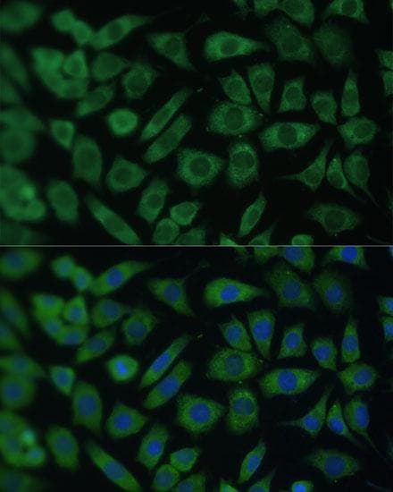 Polyclonal Rabbit anti-Human ARFL3 / ARL3 Antibody (IF)