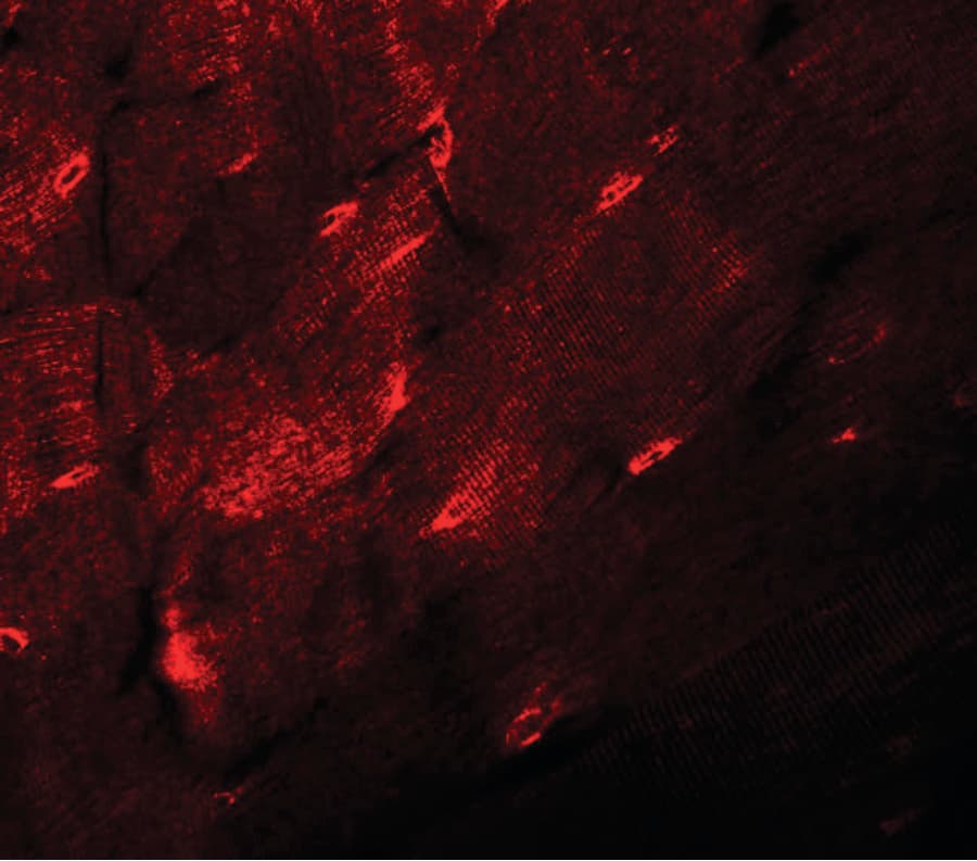 IHC-plus™ TMEM38A Antibody