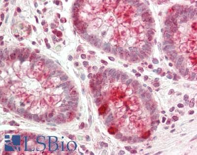 IHC-plus™ Monoclonal Mouse anti-Human WFDC2 / HE4 Antibody (IHC, WB)